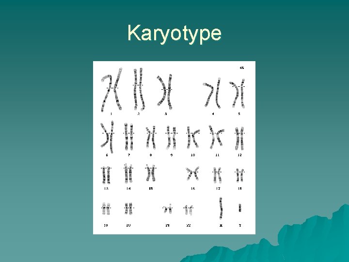 Karyotype 