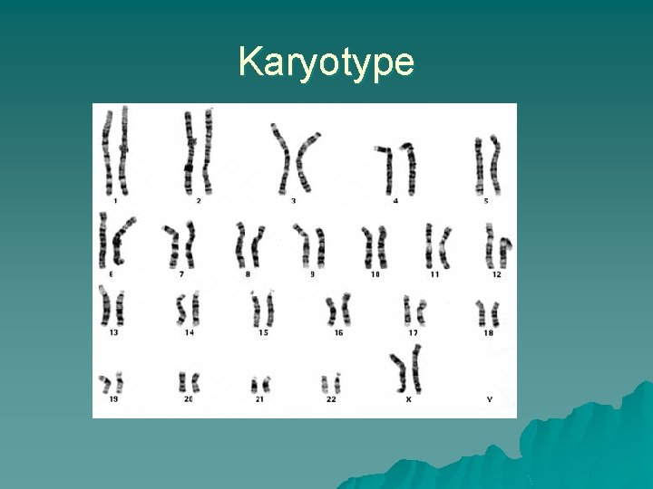 Karyotype 