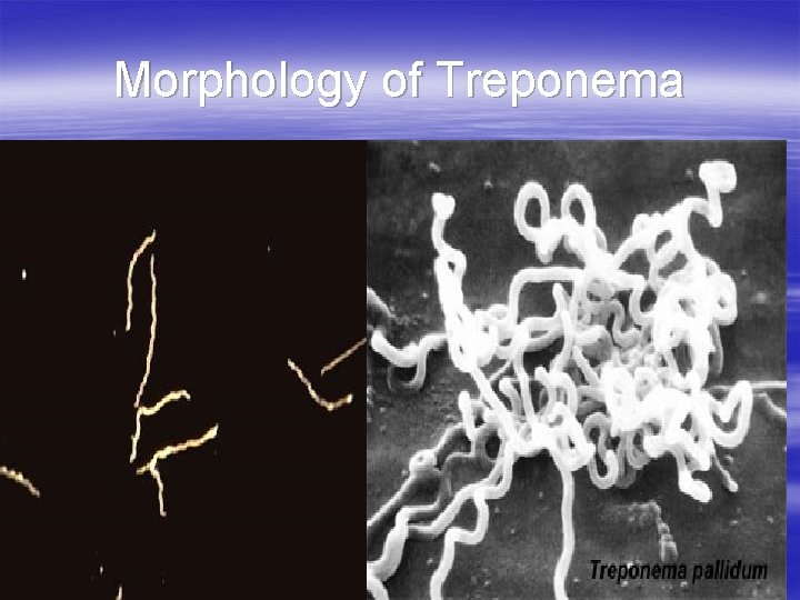 Morphology of Treponema Morphology of Treponema