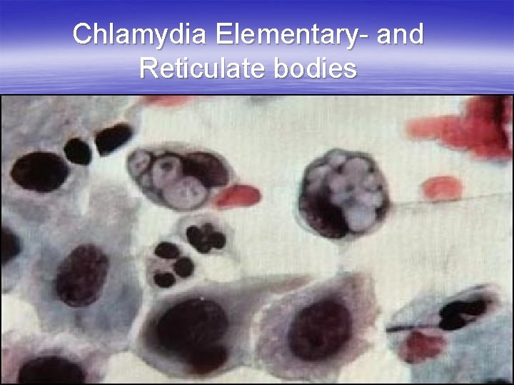 Chlamydia Elementary- and Reticulate bodies 