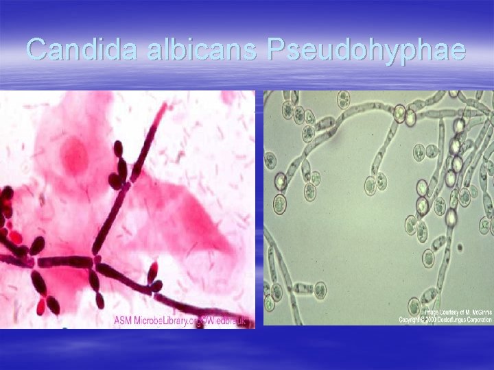 Candida albicans Pseudohyphae 