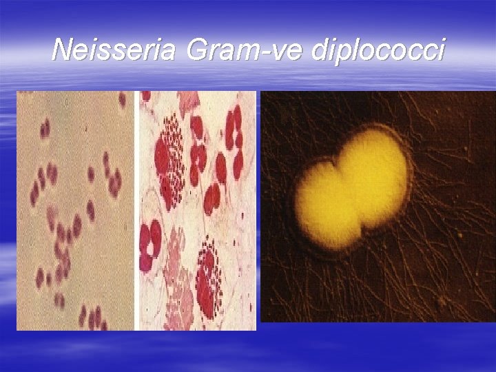 Neisseria Gram-ve diplococci 