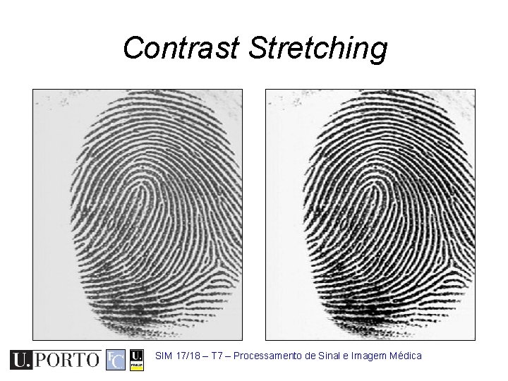 Contrast Stretching SIM 17/18 – T 7 – Processamento de Sinal e Imagem Médica