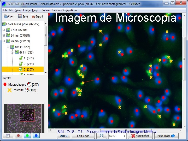 Imagem de Microscopia SIM 17/18 – T 7 – Processamento de Sinal e Imagem