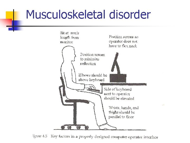 Musculoskeletal disorder 