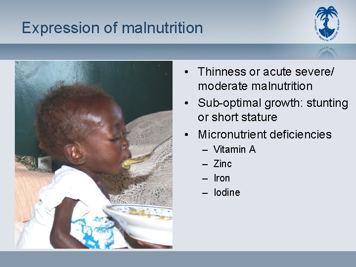 Expression of malnutrition • Thinness or acute severe/ moderate malnutrition • Sub-optimal growth: stunting