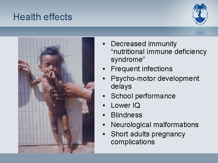 Health effects • Decreased immunity “nutritional immune deficiency syndrome” • Frequent infections • Psycho-motor
