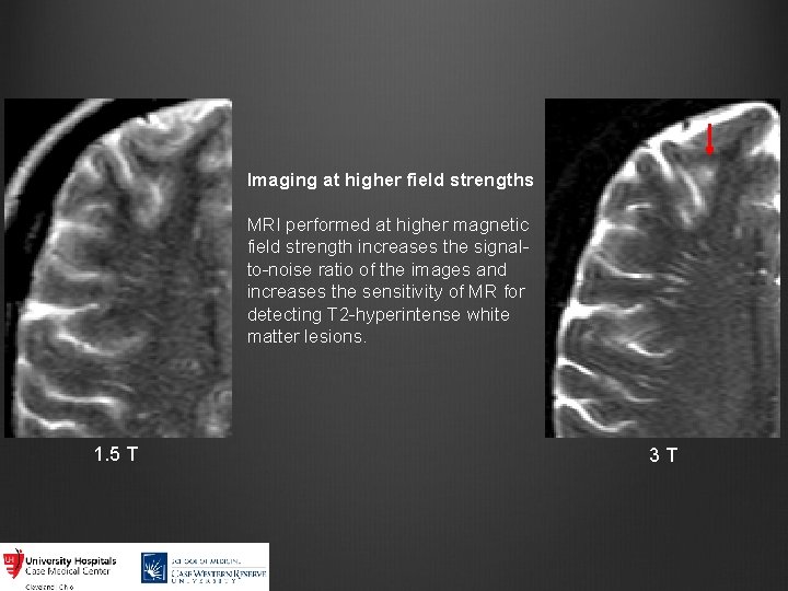 Imaging at higher field strengths MRI performed at higher magnetic field strength increases the