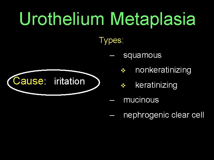 Urothelium Metaplasia Types: – squamous v nonkeratinizing Cause: iritation v keratinizing – mucinous –