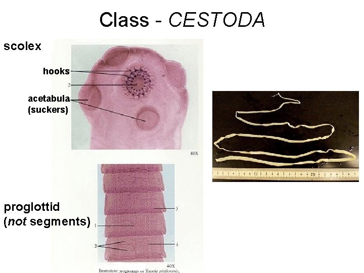 Class - CESTODA scolex hooks acetabula (suckers) proglottid (not segments) 