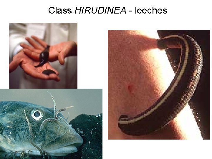 Class HIRUDINEA - leeches 