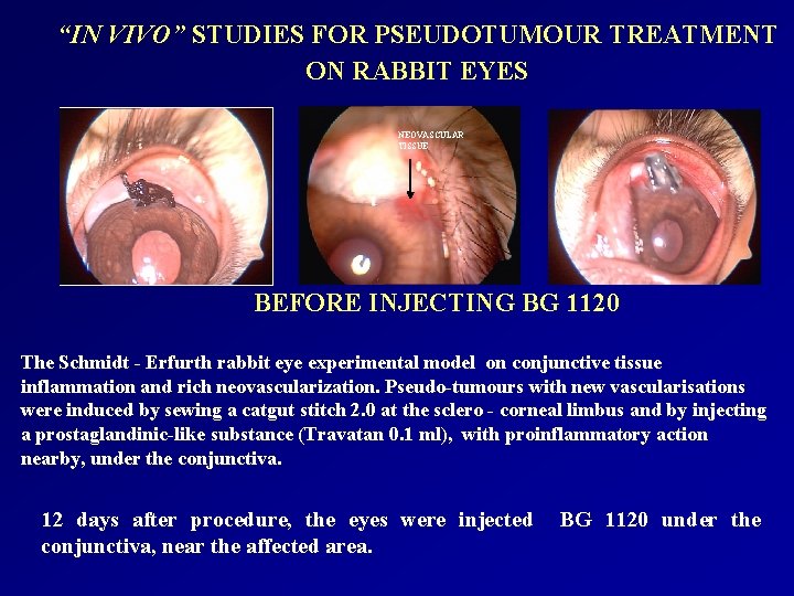 “IN VIVO” STUDIES FOR PSEUDOTUMOUR TREATMENT ON RABBIT EYES NEOVASCULAR TISSUE BEFORE INJECTING BG