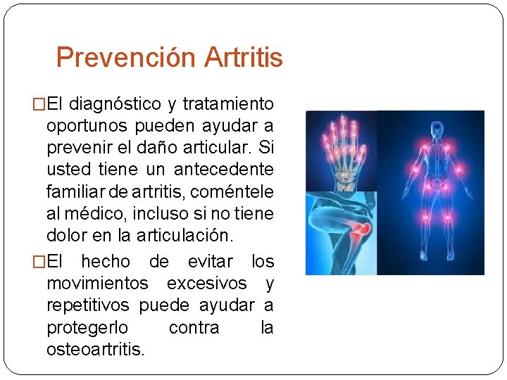 Prevención Artritis �El diagnóstico y tratamiento oportunos pueden ayudar a prevenir el daño articular.