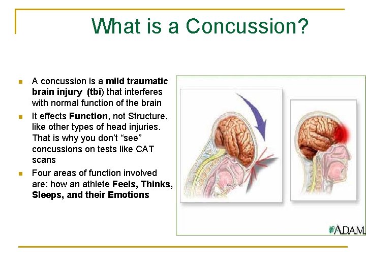 What is a Concussion? n n n A concussion is a mild traumatic brain