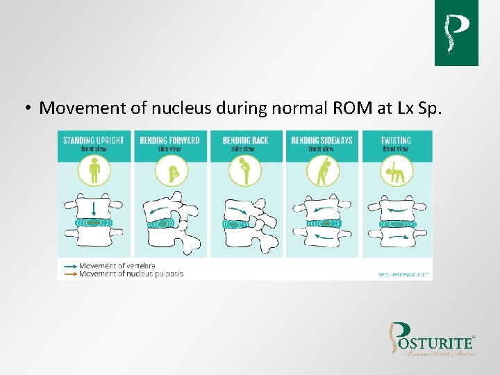 • Movement of nucleus during normal ROM at Lx Sp. • Movement of nucleus during normal ROM at Lx Sp.