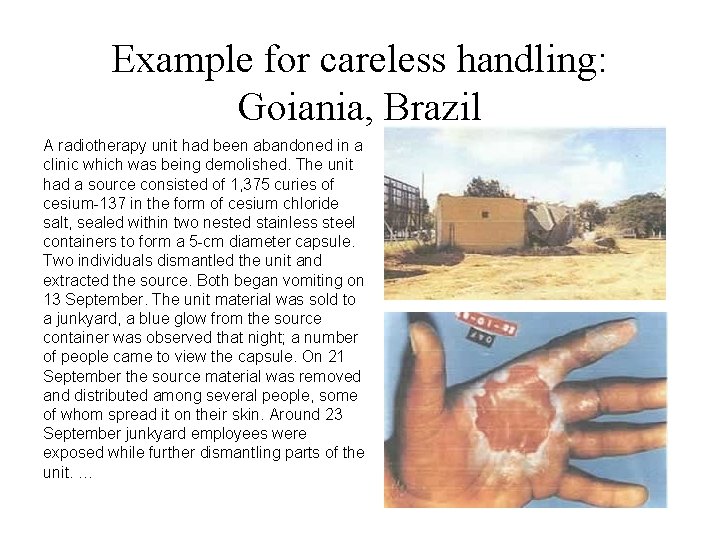 Example for careless handling: Goiania, Brazil A radiotherapy unit had been abandoned in a