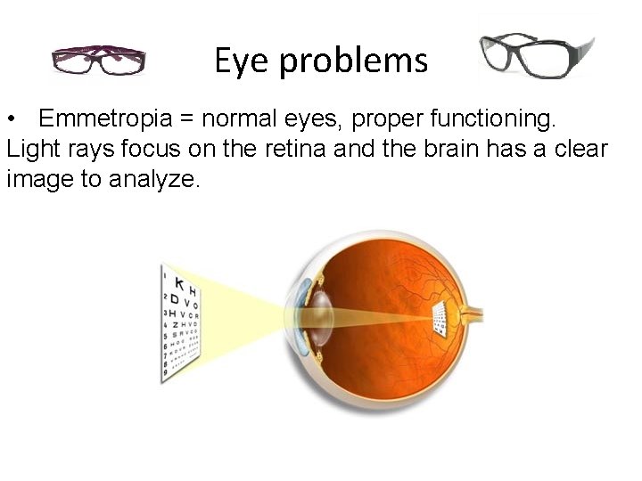 Eye problems • Emmetropia = normal eyes, proper functioning. Light rays focus on the