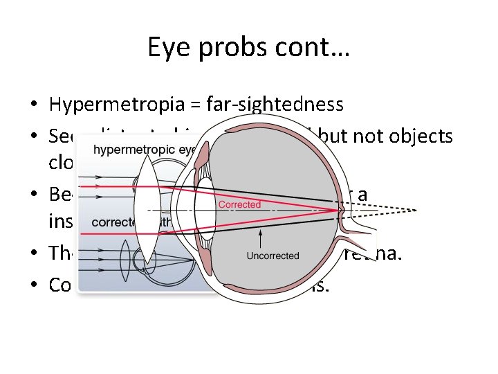 Eye probs cont… • Hypermetropia = far-sightedness • Sees distant objects very well but