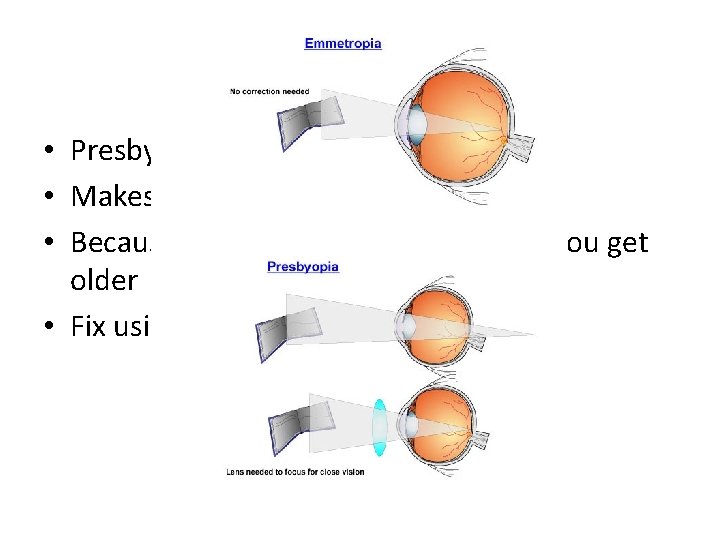 Eye probs cont. • Presbyopia: like hypermetropia • Makes nearby objects hard to see
