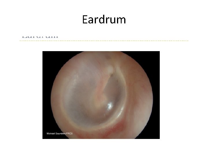 Eardrum 
