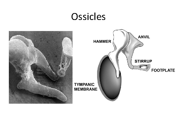 Ossicles 
