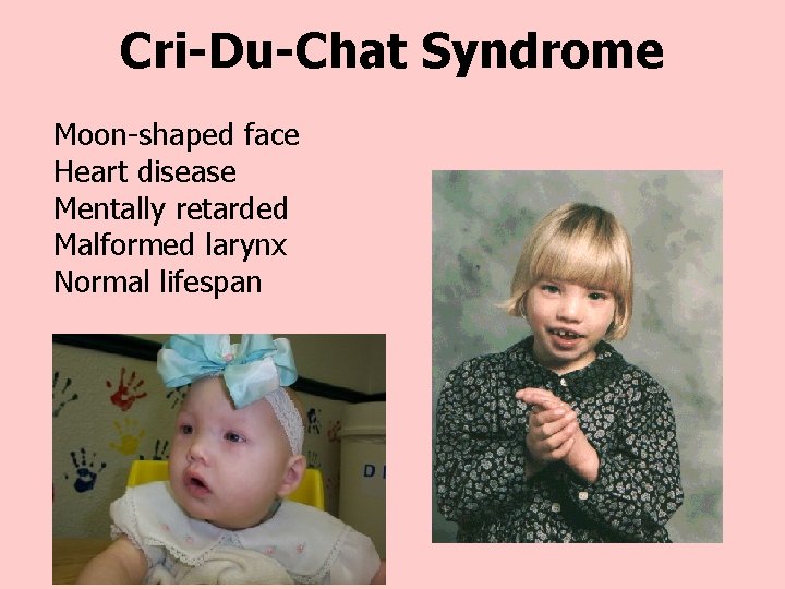 Cri-Du-Chat Syndrome Moon-shaped face Heart disease Mentally retarded Malformed larynx Normal lifespan 