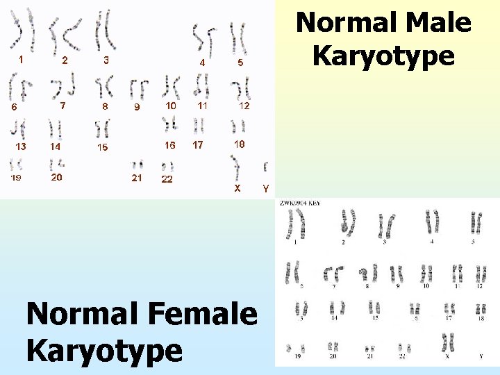 Normal Male Karyotype Normal Female Karyotype 