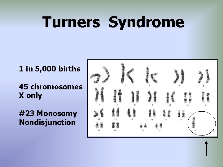Turners Syndrome 1 in 5, 000 births 45 chromosomes X only #23 Monosomy Nondisjunction