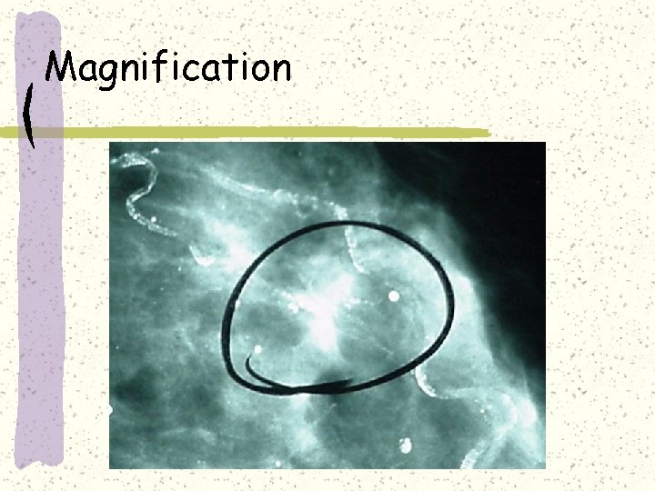 Magnification 