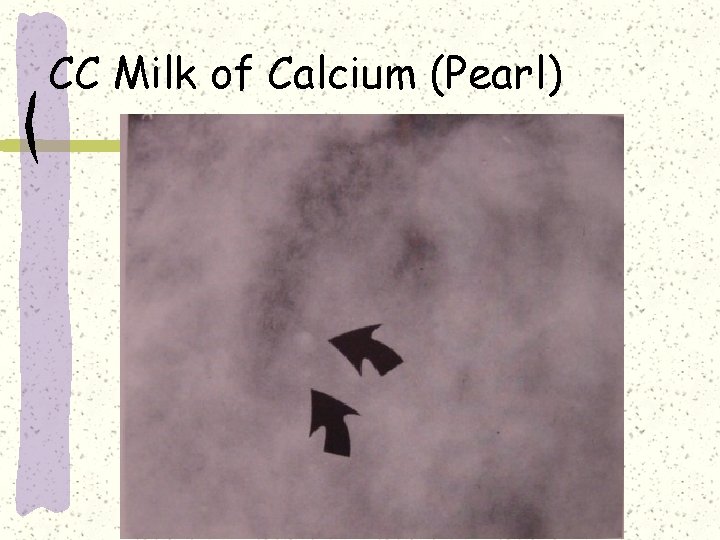 CC Milk of Calcium (Pearl) 