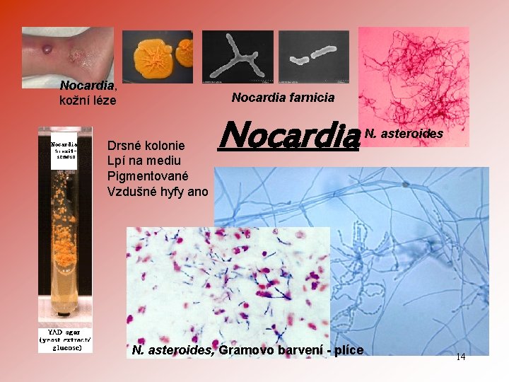 Nocardia, kožní léze Nocardia farnicia Drsné kolonie Lpí na mediu Pigmentované Vzdušné hyfy ano