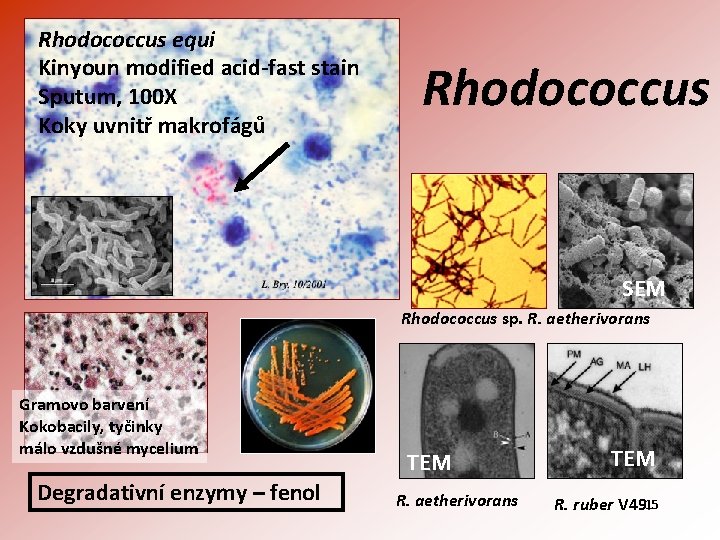 Rhodococcus equi Kinyoun modified acid-fast stain Sputum, 100 X Koky uvnitř makrofágů Rhodococcus SEM