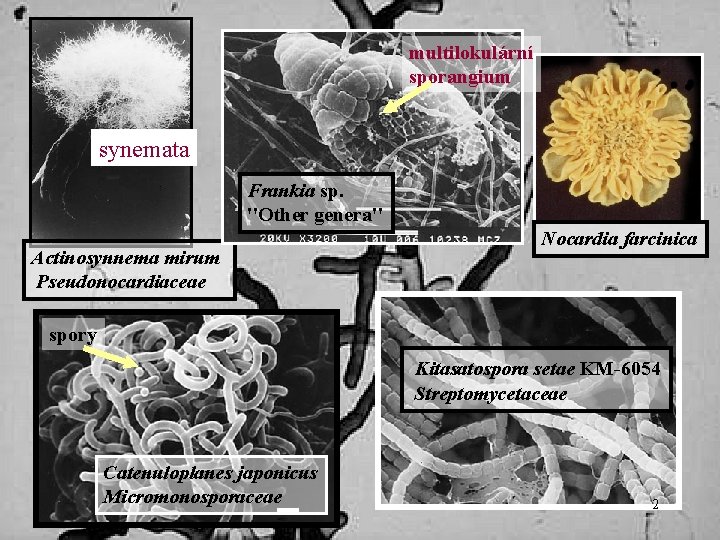 multilokulární sporangium synemata Frankia sp. ''Other genera'' Actinosynnema mirum Pseudonocardiaceae Nocardia farcinica spory Kitasatospora