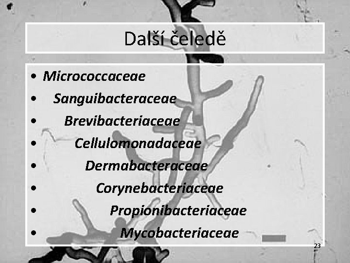 Další čeledě • • Micrococcaceae Sanguibacteraceae Brevibacteriaceae Cellulomonadaceae Dermabacteraceae Corynebacteriaceae Propionibacteriaceae Mycobacteriaceae 23 