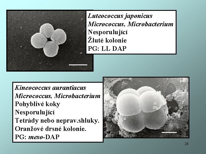 Luteococcus japonicus Micrococcus, Microbacterium Nesporulující Žluté kolonie PG: LL DAP Kineococcus aurantiacus Micrococcus, Microbacterium