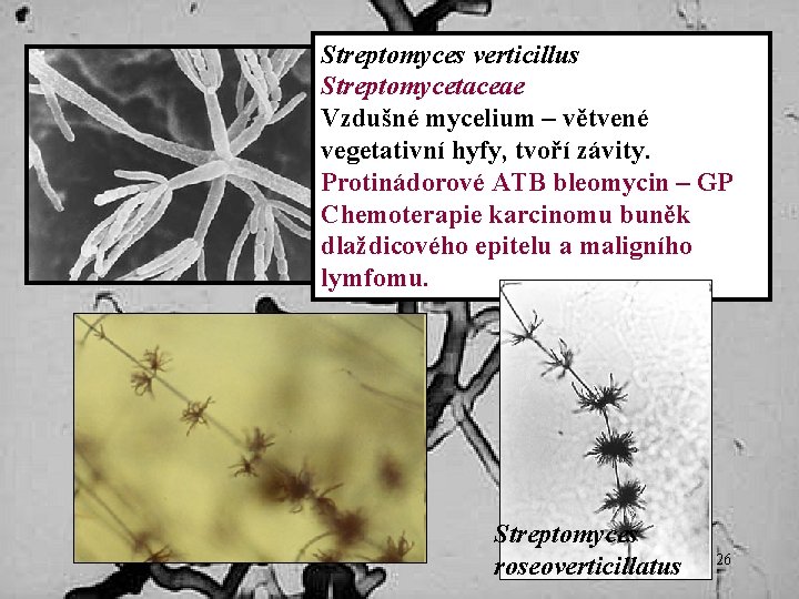 Streptomyces verticillus Streptomycetaceae Vzdušné mycelium – větvené vegetativní hyfy, tvoří závity. Protinádorové ATB bleomycin