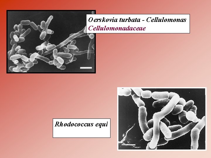 Oerskovia turbata - Cellulomonas Cellulomonadaceae Rhodococcus equi 29 