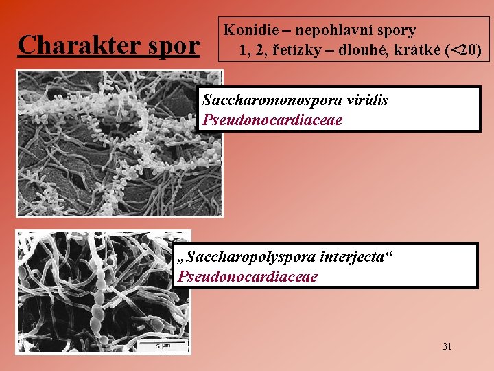 Charakter spor Konidie – nepohlavní spory 1, 2, řetízky – dlouhé, krátké (<20) Saccharomonospora