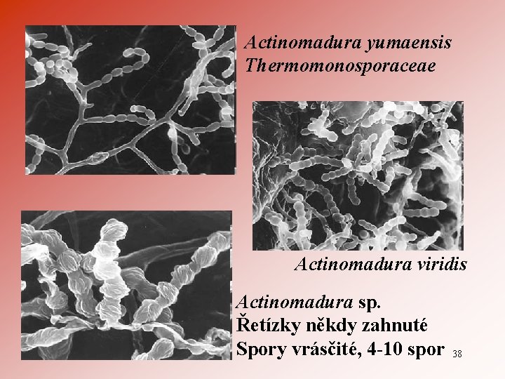 Actinomadura yumaensis Thermomonosporaceae Actinomadura viridis Actinomadura sp. Řetízky někdy zahnuté Spory vrásčité, 4 -10