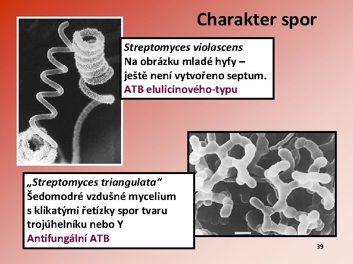Charakter spor Streptomyces violascens Na obrázku mladé hyfy – ještě není vytvořeno septum. ATB
