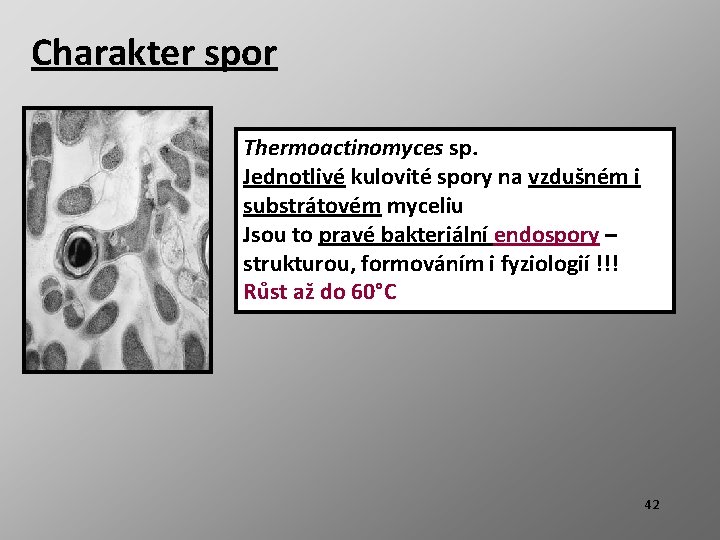 Charakter spor Thermoactinomyces sp. Jednotlivé kulovité spory na vzdušném i substrátovém myceliu Jsou to