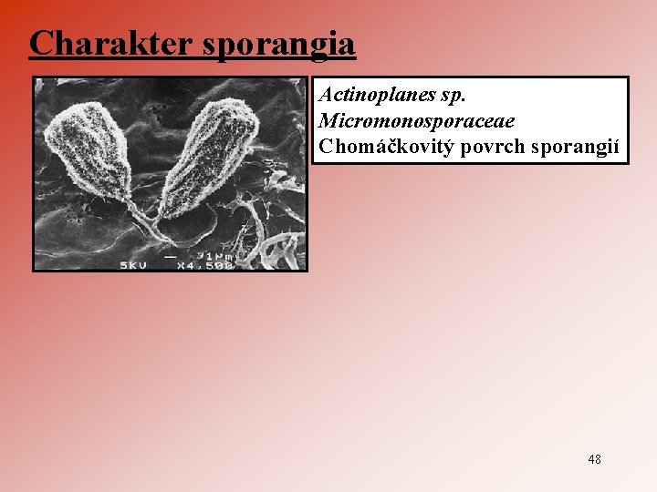 Charakter sporangia Actinoplanes sp. Micromonosporaceae Chomáčkovitý povrch sporangií 48 
