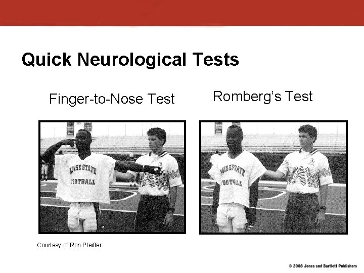 Quick Neurological Tests Finger-to-Nose Test Courtesy of Ron Pfeiffer Romberg’s Test 