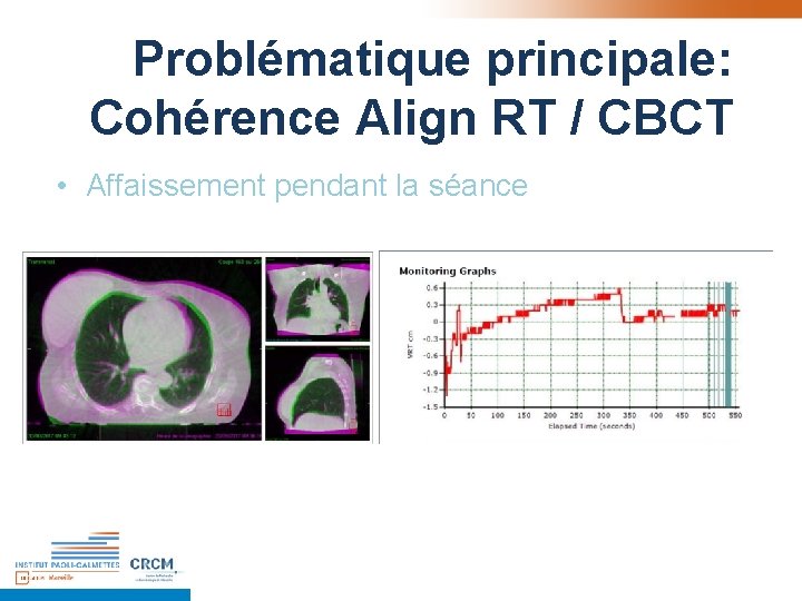 Problématique principale: Cohérence Align RT / CBCT • Affaissement pendant la séance Problématique principale: Cohérence Align RT / CBCT • Affaissement pendant la séance