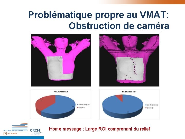 Problématique propre au VMAT: Obstruction de caméra Home message : Large ROI comprenant du Problématique propre au VMAT: Obstruction de caméra Home message : Large ROI comprenant du