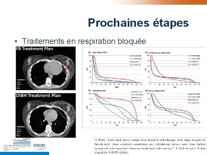 Prochaines étapes • Traitements en respiration bloquée Prochaines étapes • Traitements en respiration bloquée