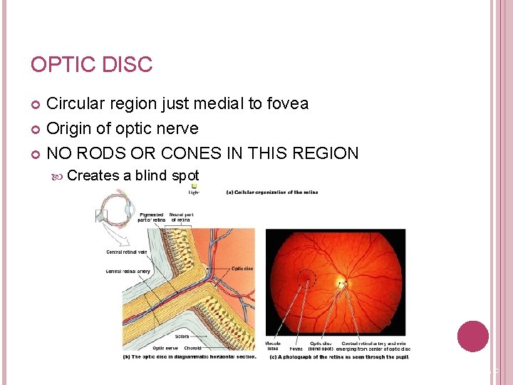 OPTIC DISC Circular region just medial to fovea Origin of optic nerve NO RODS