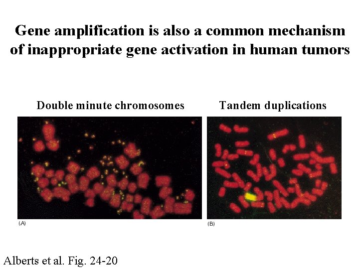 Gene amplification is also a common mechanism of inappropriate gene activation in human tumors