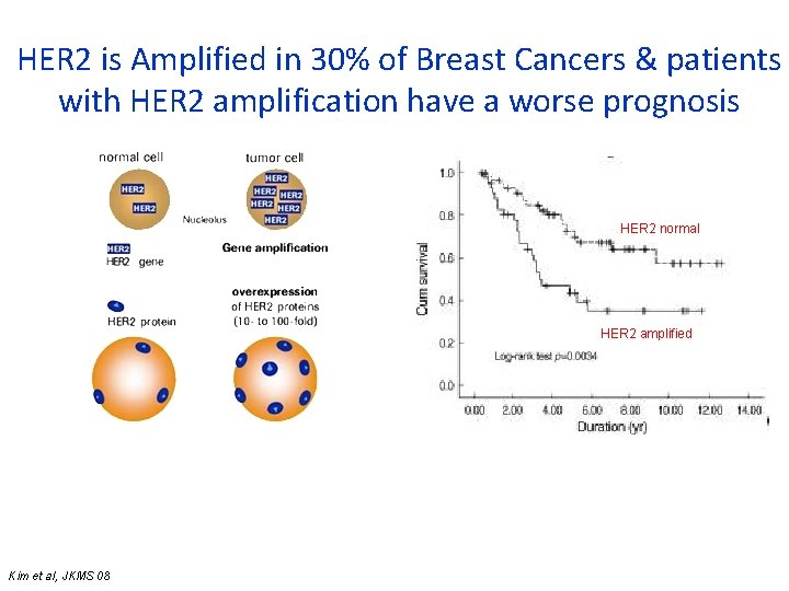 HER 2 is Amplified in 30% of Breast Cancers & patients with HER 2