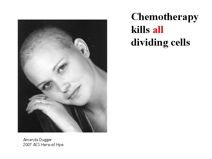 Chemotherapy kills all dividing cells Amanda Dugger 2007 ACS Hero of Hpe 